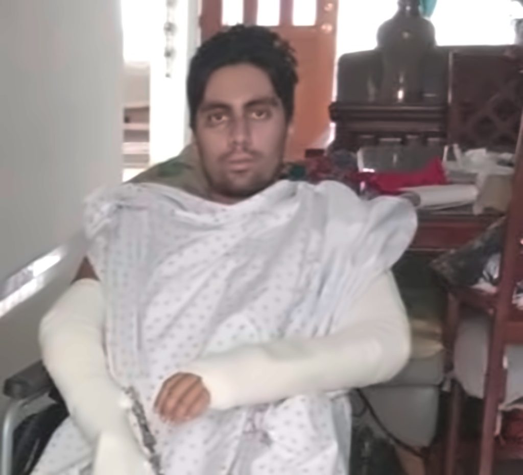 Paciente en recuperación